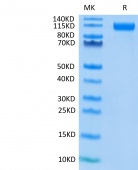 Recombinant SARS-COV-2 Spike S1(D614G) Protein (RP02329)