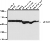 [One Step]UQCRC2 Antibody Kit (RK05719)