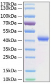 Active Recombinant Human TNFRSF17/BCMA/CD269 Protein (RP00155)