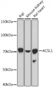 ACSL1 Rabbit pAb (A16253)