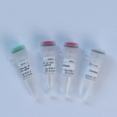 SweScript All-in-One First-Strand cDNA Synthesis SuperMix for qPCR (One-Step gDNA Remover)