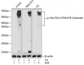Phospho-(Ser/Thr) ATM/ATR Substrate Rabbit pAb (AP0933)