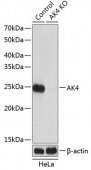 [KO Validated] AK4 Rabbit pAb (A19854)