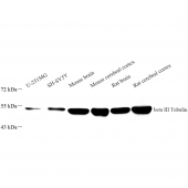 Recombinant Anti -beta III Tubulin antibody ( Mouse mAb )