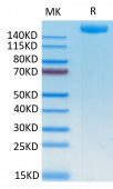 Recombinant SARS-COV-2 Spike S1+S2 ECD(S-ECD) Protein (RP02334)