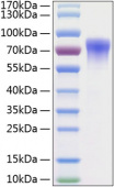 Recombinant Human GDNFR-alpha-2/GFRA2 Protein (RP00199)