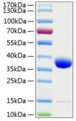 Active Recombinant Human Prolactin receptor/PRL-R Protein (RP00128)