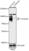 [KO Validated] Cortactin Rabbit pAb (A18038)