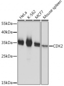 [KO Validated] CDK2 Rabbit pAb (A16885)