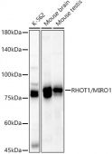 [KD Validated] RHOT1/MIRO1 Rabbit pAb (A22551)
