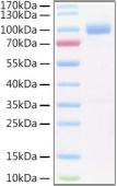 Active Recombinant Human IL-6RA/CD126 Protein (RP01396)