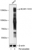Phospho-BCAR1-Y410 Rabbit pAb (AP0789)