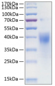 Active Recombinant Human IFN-gamma R1/CD119 Protein (RP00200)
