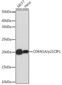 [KO Validated] CDKN1A/p21 Rabbit mAb (A19094)