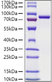 Recombinant Mouse Transferrin/TF Protein (RP01482)