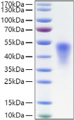 Recombinant Mouse TNFRSF1B/TNF-R2/CD120b Protein (RP01375)
