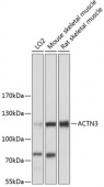 ACTN3 Rabbit pAb (A12864)