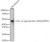 Zinc-α2-glycoprotein (ZAG/AZGP1) Rabbit mAb (A11680)