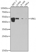 [KO Validated] VRK1 Rabbit pAb (A7745)