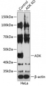 [KO Validated] ADK Rabbit pAb (A19992)