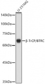 β-TrCP/BTRC Rabbit pAb (A1656)