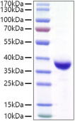 Recombinant SARS-CoV-2 Spike RBD(Lambda/C.37)  Protein (RP01492)