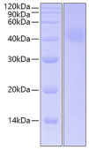 Recombinant Human IL-20RA Protein (RP00537)