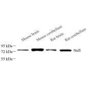 Anti -68kDa Neurofilament/NF-L Rabbit pAb