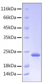 Active Recombinant Human Somatotropin/GH-N/GH1 Protein (RP00033)