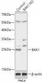 [KO Validated] Bak Rabbit pAb (A18002)
