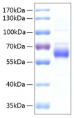 Recombinant Human FGFR-5/FGFRL1 Protein (RP00134)
