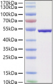 Recombinant SARS-COV-2 Nucleocapsid(B.1.1.529/Omicron) Protein (RP01485LQ)