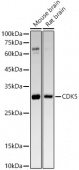 [KO Validated] CDK5 Rabbit mAb (A23502)