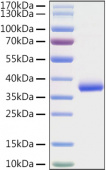 Recombinant SARS-COV-2 Spike RBD(K417N) Protein (RP01329)