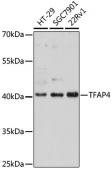 [KO Validated] TFAP4 Rabbit pAb (A16727)