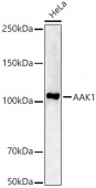AAK1 Rabbit pAb (A22105)