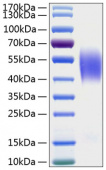 Active Recombinant Human CEACAM6/CD66c Protein (RP00982)