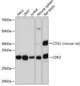 [KO Validated] CDK2 Rabbit mAb (A0094)