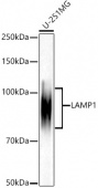 [KO Validated] LAMP1 Rabbit mAb (A21194)