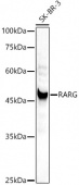 [KD Validated] RARG Rabbit pAb (A21785)