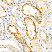 Anti -AC5 Rabbit pAb