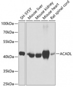 ACADL Rabbit pAb (A1266)