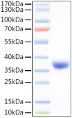 Recombinant SARS-COV-2 Spike RBD(L452R, T478K)  Protein (RP01475)