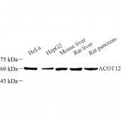 Anti -ACOT12 Rabbit pAb