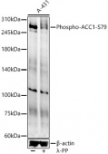 Phospho-ACC1-S79 Rabbit pAb (AP0298)