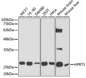 [KO Validated] HPRT1 Rabbit pAb (A5692)