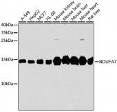 [KO Validated] NDUFA7 Rabbit pAb (A8441)