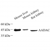 Anti -AADAC/DAC Rabbit pAb