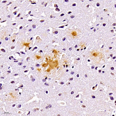 Anti -Amyloid beta 40 Mouse mAb