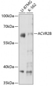 ACVR2B Rabbit pAb (A7868)